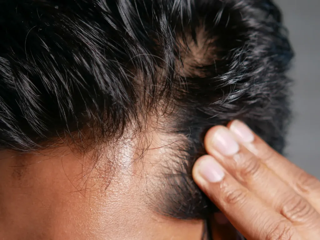 Necesidades del cabello: cómo saber qué necesita el tuyo